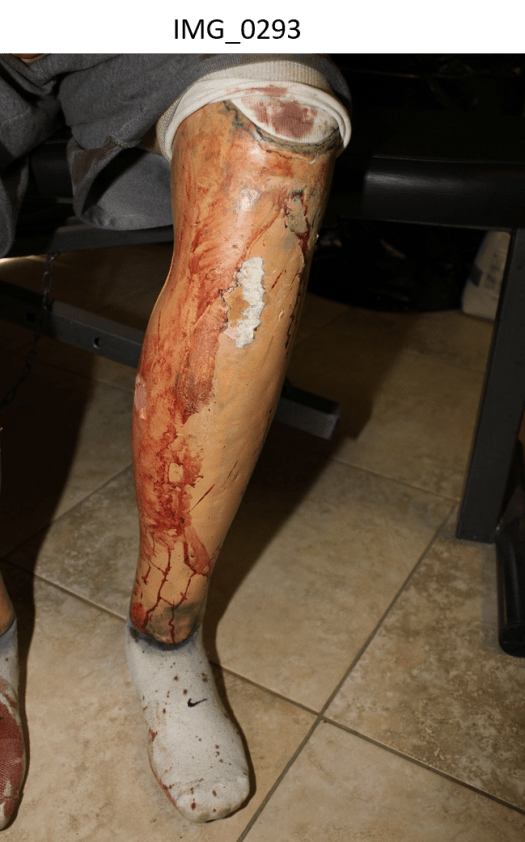 Oscar battered legs 3